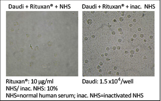 Cost-effective Custom Polyclonal Antibodies Services
